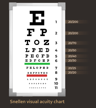 Understanding Eye Examination